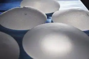 Mammogram for implants. 2 Breast Implants