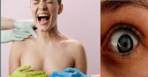 Mammogram pain expression