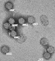 Electron microphotograph of virus-like particle used in Gardasil manufacturing