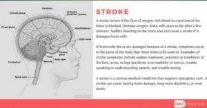 Cerebrovascular accident vs tia