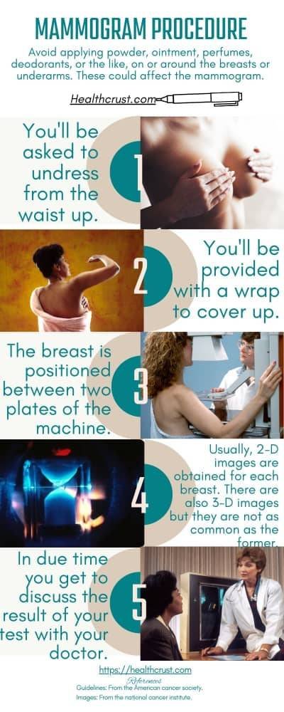 Step-by-step procedures of a mammogram.