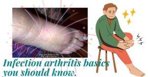 infection arthritis
