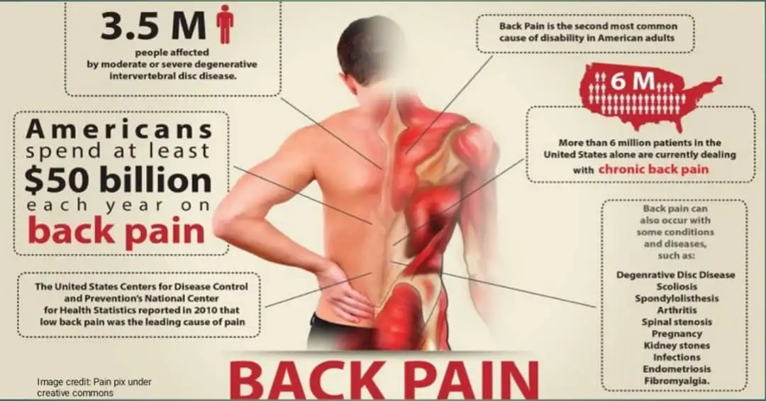 Treatments for arthritis of the spine. 1 Treatments for arthritis of the spine