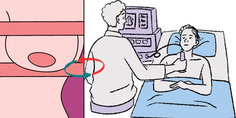 Mammogram vs. Breast Ultrasound